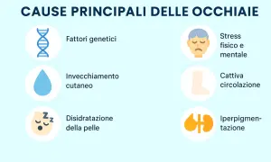 Le cause delle occhiaie includono fattori genetici, invecchiamento, disidratazione, stress fisico e mentale, cattiva circolazione e iperpigmentazione.
