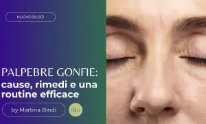 Occhio chiuso con palpebre gonfie, rughe sottili e ciglia scure. Il testo parla di cause e rimedi per le palpebre gonfie.