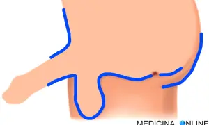 Illustrazione anatomica di parti intime maschili con contorni blu. Potrebbe rappresentare un trattamento di luce pulsata per la depilazione.