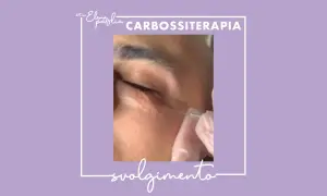 Trattamento di carbossiterapia per le borse sotto gli occhi, con iniezione di CO2.