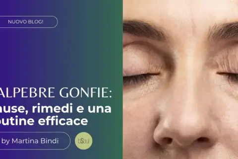Occhio chiuso con palpebre gonfie, rughe sottili e ciglia scure. Il testo parla di cause e rimedi per le palpebre gonfie.