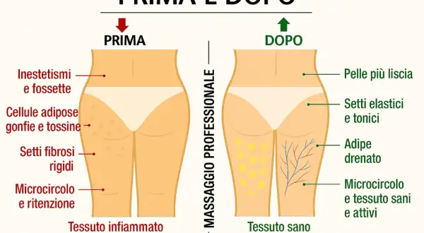 Prima e dopo massaggio: la cellulite con buchi e tessuti bloccati diventa pelle liscia, con adipe drenato e microcircolo attivo.