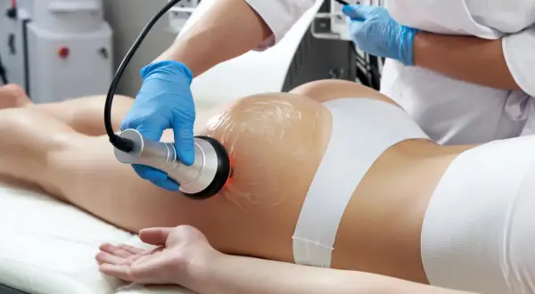 Trattamento estetico con manipolo per sciogliere grasso localizzato su glutei e gambe.