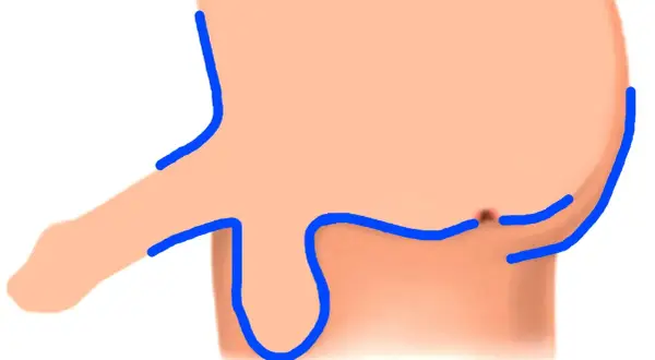 Illustrazione anatomica di parti intime maschili con contorni blu. Potrebbe rappresentare un trattamento di luce pulsata per la depilazione.