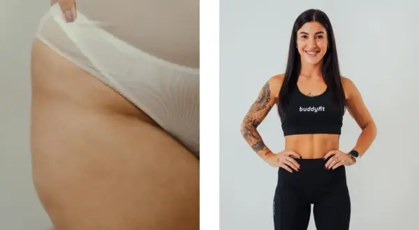 Dettaglio di culotte de cheval, causa di inestetismi della pelle, accanto a una donna sorridente in abbigliamento sportivo.