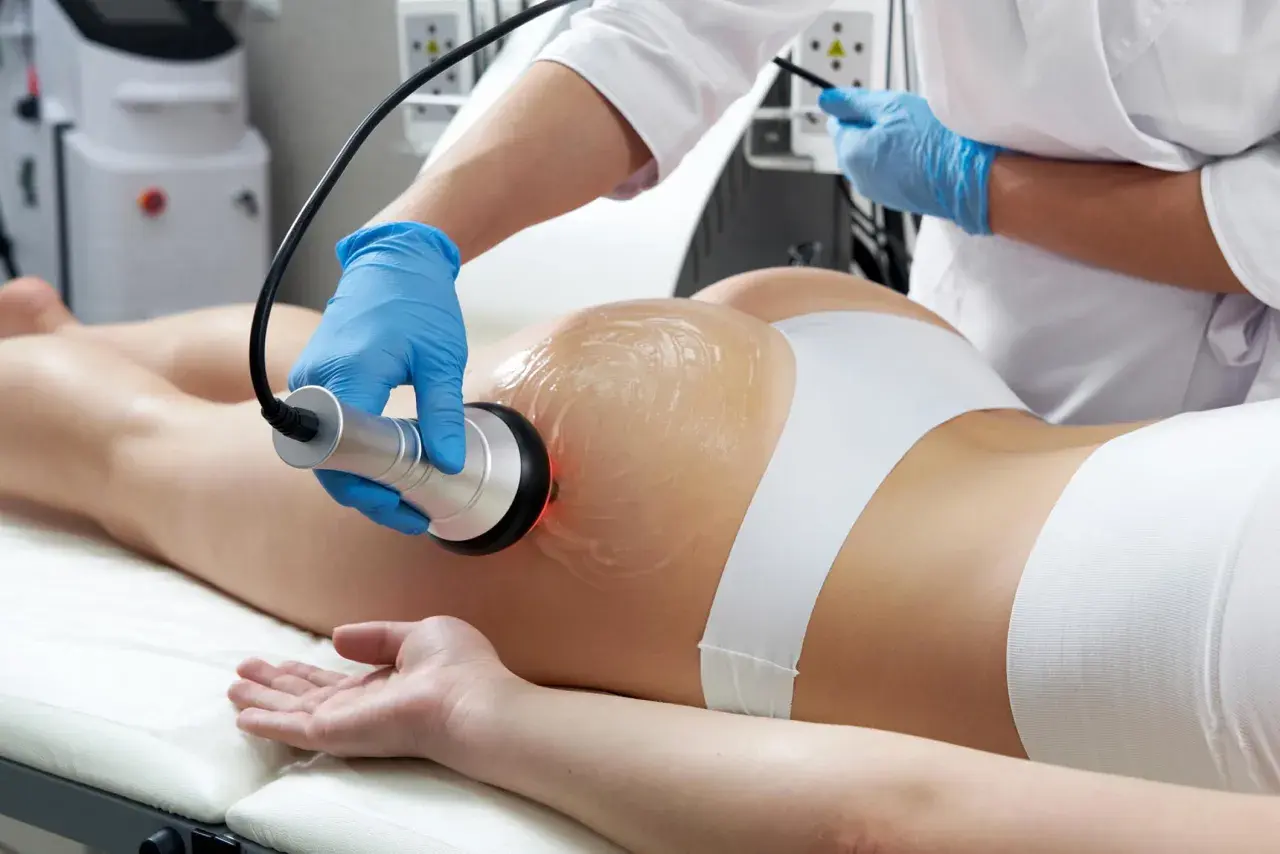 Trattamento estetico con manipolo per sciogliere grasso localizzato su glutei e gambe.