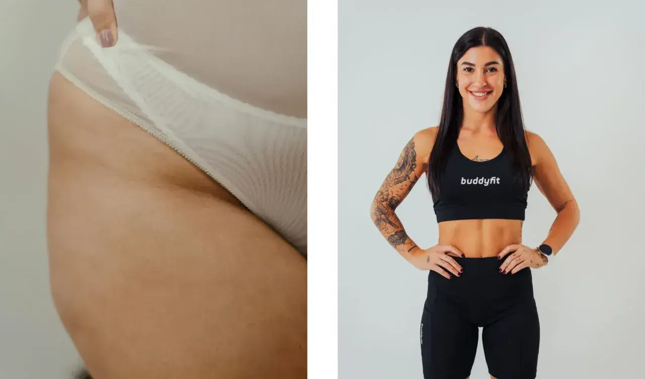 Dettaglio di culotte de cheval, causa di inestetismi della pelle, accanto a una donna sorridente in abbigliamento sportivo.