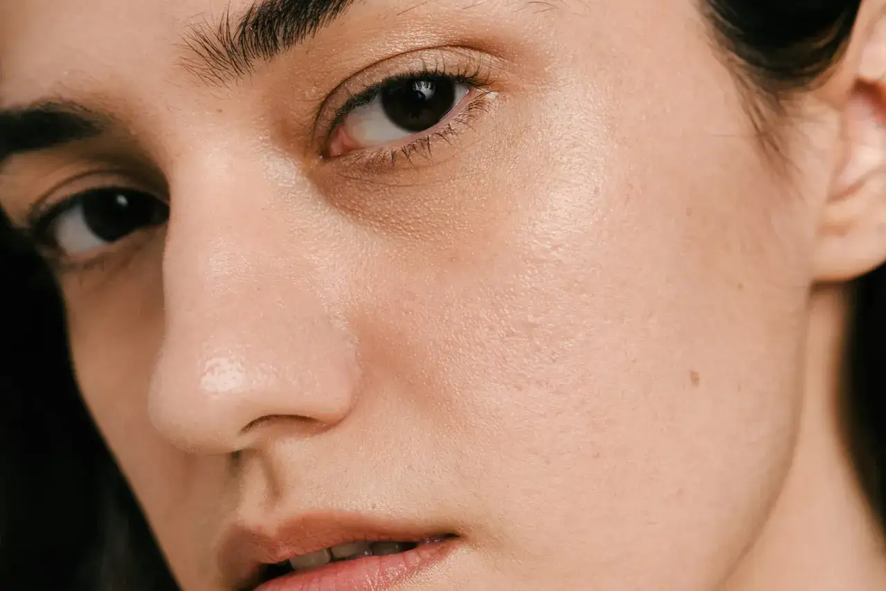 Viso con pelle luminosa e uniforme dopo carbon peel. Risultati visibili, pelle levigata e radiosa.