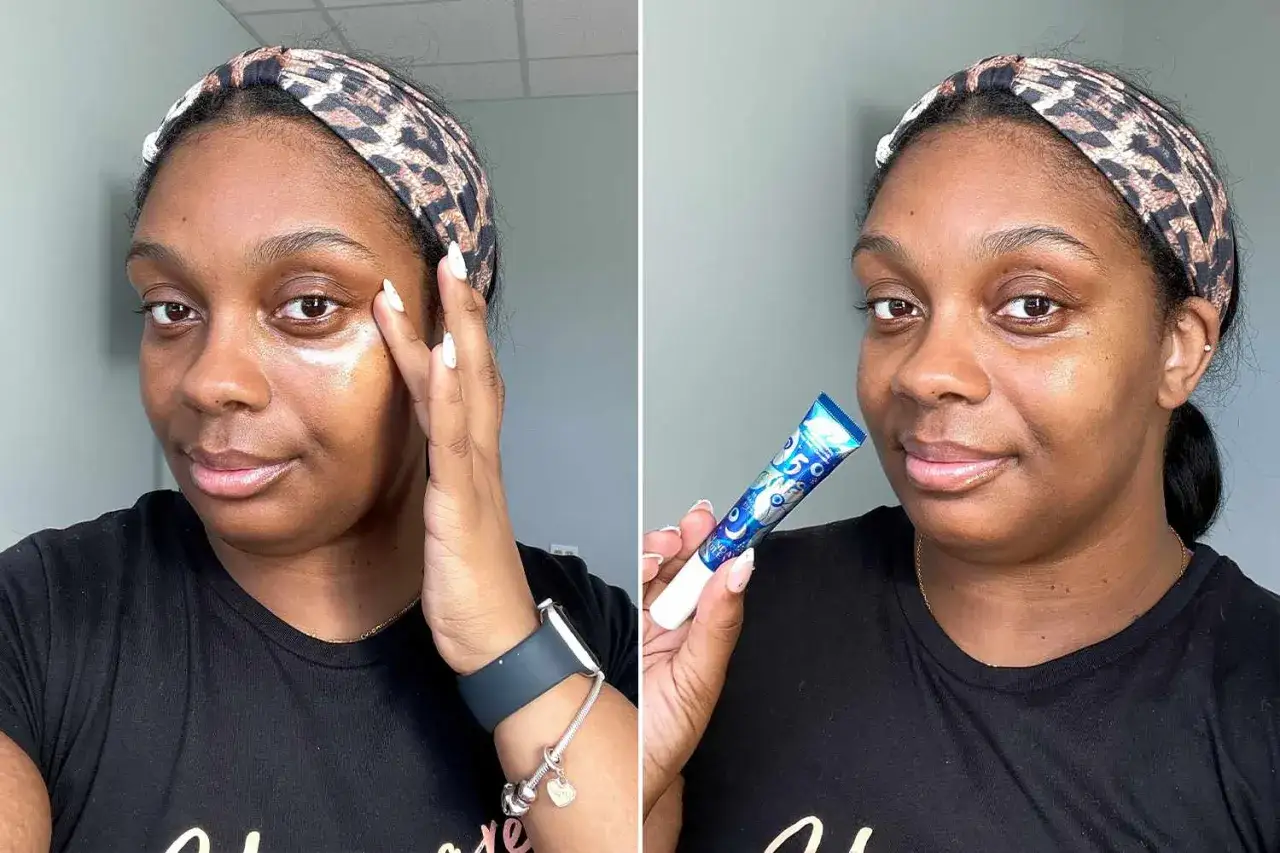 Donna applica crema contorno occhi per combattere le occhiaie da stress. Mostra il tubetto del prodotto.