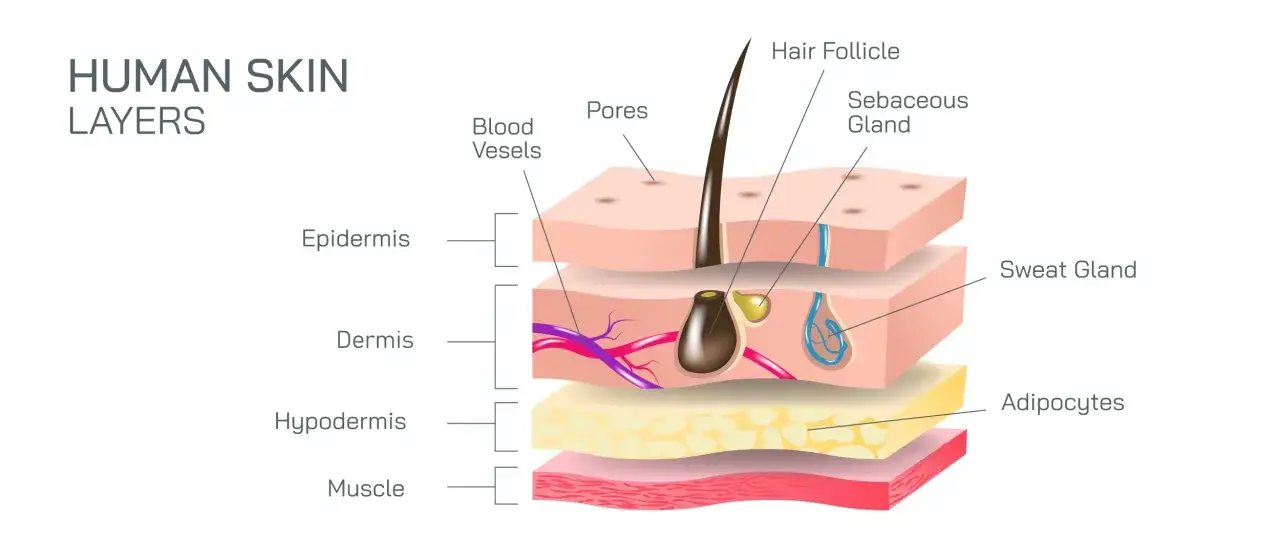 Sezione trasversale della pelle umana che mostra epidermide, derma, ipoderma e muscolo, con follicoli piliferi, ghiandole sebacee e sudoripare.