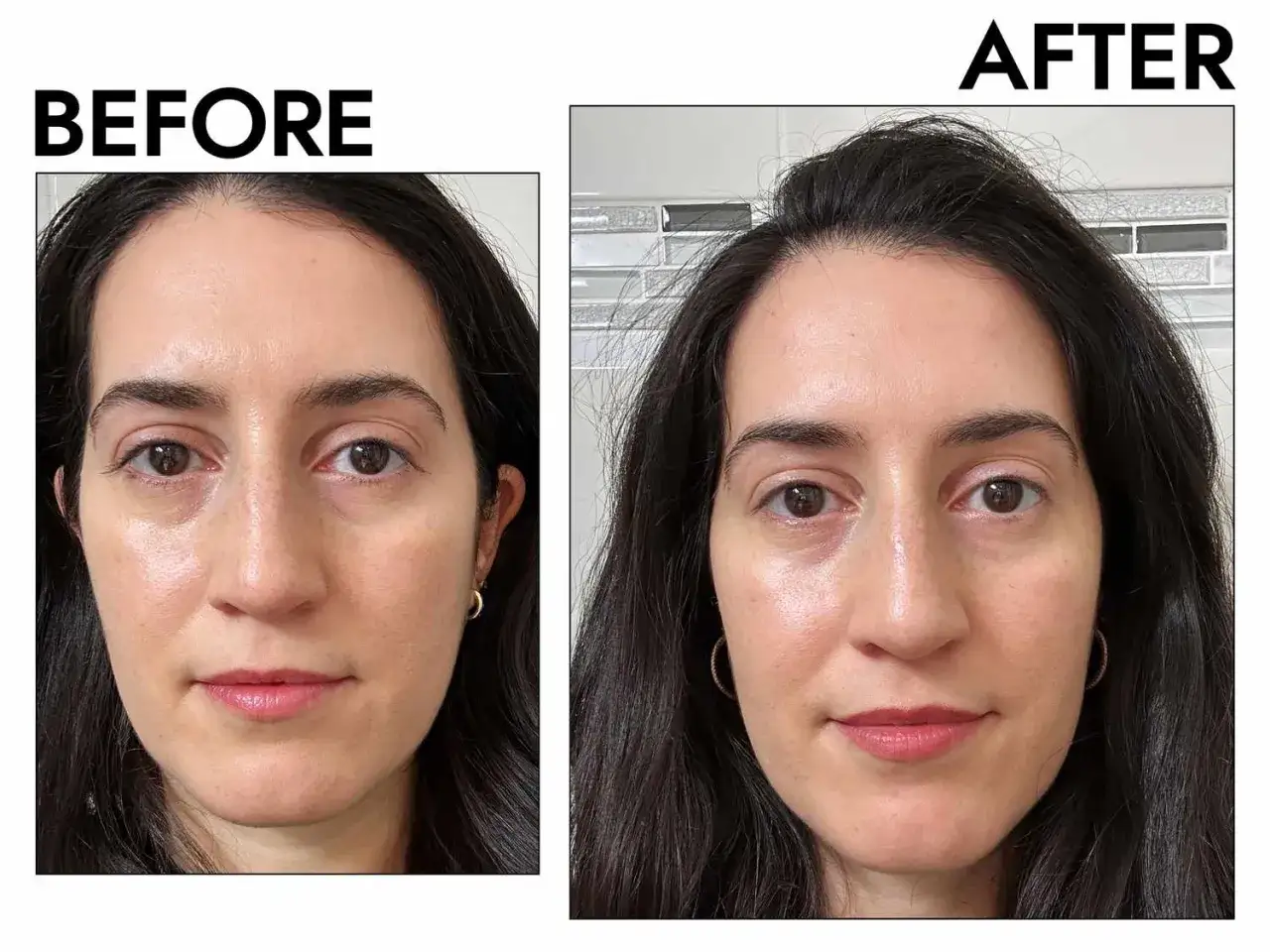 Prima e dopo: la pelle appare più luminosa e uniforme. La niacinamide e zinco a cosa serve? A migliorare l'incarnato e ridurre le imperfezioni.