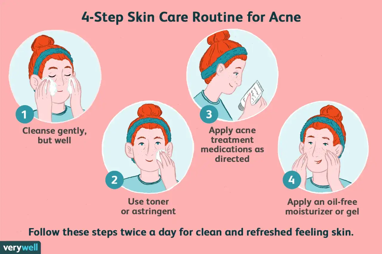 Routine in 4 step per la pulizia viso acne: detersione, tonico, farmaci specifici e idratazione oil-free.