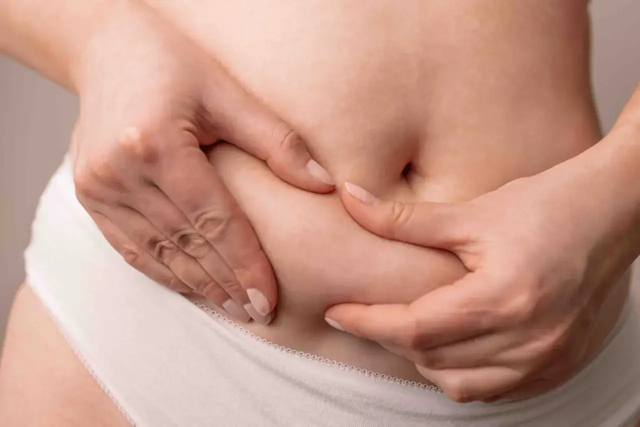 Mani che stringono la pancia, mostrando la texture della pelle con cellulite.