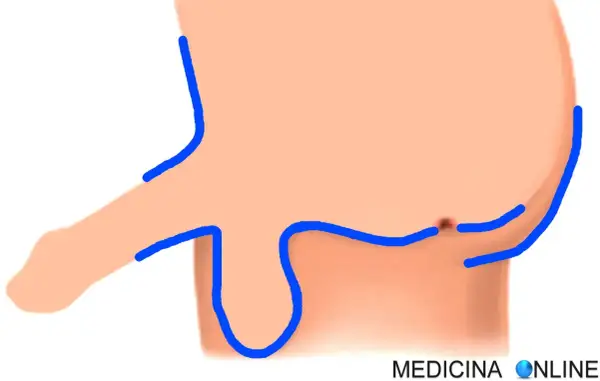 Illustrazione anatomica di parti intime maschili con contorni blu. Potrebbe rappresentare un trattamento di luce pulsata per la depilazione.