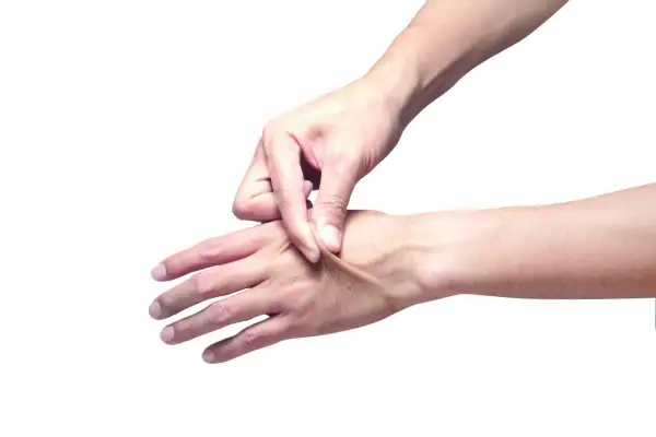 Dita che pizzicano la pelle del dorso della mano, mostrando la sua elasticità.